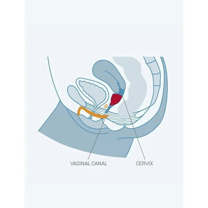 Copa Menstrual Grosse
